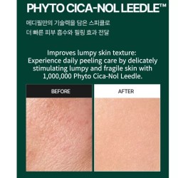 Gentle Exfoliating Serum with Spicules Phyto Cica-Nol B5 3000 Shot