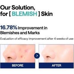 MEDIHEAL Madecassoside Blemish Pad 100tk
