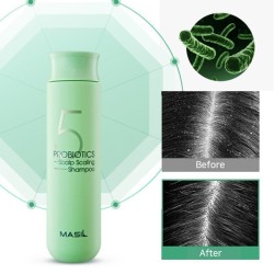 Masil 5 Probiotics Scalp Scaling Shampoo 300ml